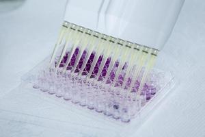 cell culture at the medicine, medical and cell culture laboratory photo