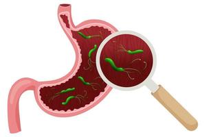 Helicobacter pylori in empty stomach under magnifying glass. Vector illustration, cartoon style