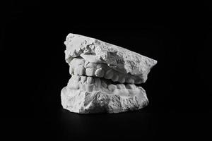 molde de fundición de dientes de la mandíbula hecho de yeso para trabajo de ortodoncista foto