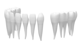 3D Dental Implant - Tooth Implant - on White Background video