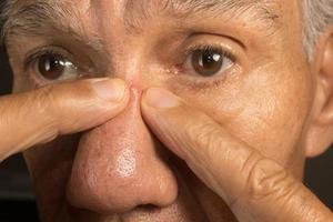 Man trying to pop a pimple on the bridge or his nose. photo