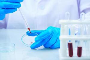 científico analizando una muestra de sangre en una bandeja en el laboratorio