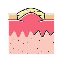 boxcar acne scar color icon vector illustration