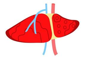 Liver flat design vector for website and mobile website development, apps are presented. Viral hepatitis A, B, C, D is symbol, cirrhosis icon.