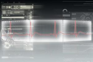 Digital illustration of heart monitor screen with normal beat signal photo