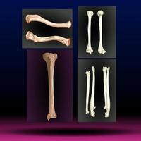 huesos - piernas - partes del cuerpo - miembro - mano - brazo foto