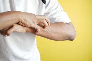 man suffering from itching skin, close up. photo