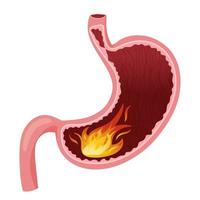 Flame in human stomach illustration vector