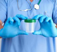 médico con uniforme azul y guantes de látex sostiene un recipiente de plástico vacío para tomar muestras de orina foto