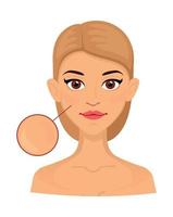 mujer diferentes tipos de piel normal, área ampliada para cosmetología. acné, arrugas y manchas de la edad. vector