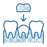 Stomatology Tooth Crown doodle icon hand drawn illustration vector