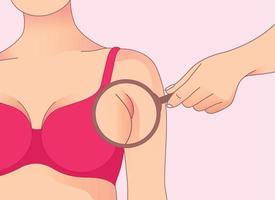 Breast fat transfer lift asymmetrical nipple sag rejuvenate surgery  implantation small size droop 22650184 Vector Art at Vecteezy