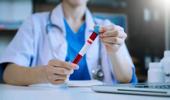 Coronavirus testing. The doctor holds in his hand a test tube with blood sample with a positive result. photo