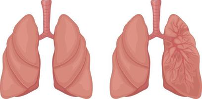 humano pulmones. el anatomía de humano pulmones. el interno Organo de un persona. vector ilustración aislado en un blanco antecedentes