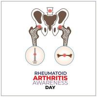 Rheumatoid Arthritis Awareness Day. 2 February. Template for background, banner, card, poster. vector illustration.