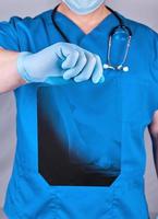 doctor in blue uniform and latex gloves holding a bone X-ray photo