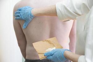 A nurse smears a body covered with an allergic rash to a patient.The hands of a doctor smear a person's skin with a white ointment. photo