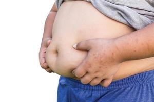 Boy fat and Unhealthy on isolated white with clipping path. photo