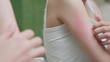 Haut Problem und Schönheit. jung Frau kratzen Körper hat juckend Haut von Haut allergisch, Steroid Allergie, empfindlich Haut, rot von Sonnenbrand, chemisch Allergie, Ausschlag, Insekt bisschen video