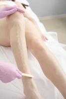 Hair removal procedure, applying gel on woman's leg. laser epilation salon. professional skin care photo