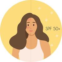 People UV skin protection. Using gel with spf. Sun protection infographic. Vector flat illustration. Skin care, skin care. Burn protection. Use sunscreen