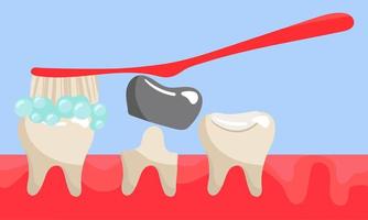 A set of teeth on the gums with a brush, with a crown and clean, a seal and no tooth. They clean the tooth, the tooth with a silver crown, sealed, the gum without a tooth. Flat style vector