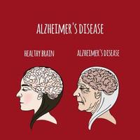 Alzheimer enfermedad demencia medicina vector ilustración