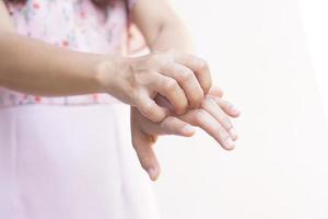 Asian woman having itchy hands photo