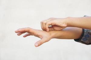 Asian woman having an itchy arm photo