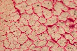 covid19 lung coronavirus virus affected macro photo
