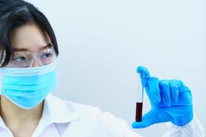 Scientist analyzing holding blood sample in test tube photo