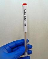 Sputum Culture Test for the diagnosis of Tuberculosis or TB photo