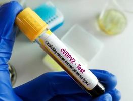 Blood sample for cVDPV2 or circulating vaccine-derived poliovirus type 2 test. photo
