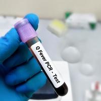 Blood sample for Q fever or query fever is a disease caused by infection with Coxiella burnetii. photo