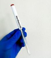 Scientist holding Nasopharyngeal swab for Avian Influenza A-H5 test. photo