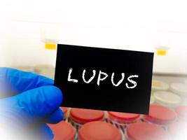 lupus médico término, médico investigación y desarrollo conceptual imagen. foto