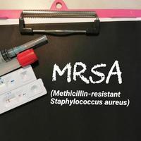 mrsa o resistente a la meticilina estafilococo áureo, médico conceptual imagen. foto