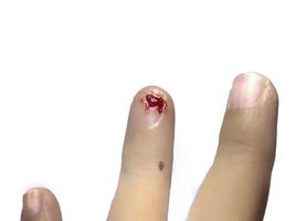 bleeding wound on finger at left hand with white background, bleeding on little finger, soft and blurry focus photo