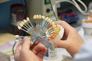 A palette for determining the color of teeth in the hands of a dental orthopedist. photo