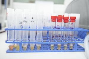 Medical test tubes with urine tests in a biochemical laboratory. photo