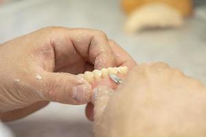 Manufacturing of dentures. Orthopedist's hands make jaw prostheses. photo