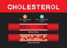 colesterol en artería, salud riesgo , acumulación sangre, obesidad, vector diseño