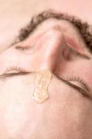 Liquid wax between the eyebrows of a young man photo