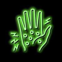 dyshidrotic eczema neon glow icon illustration vector