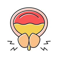 ilustración de vector de icono de color de canal de orina de bloqueo de próstata