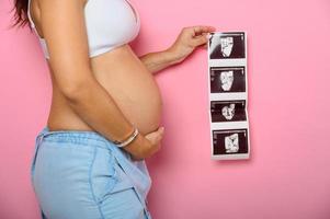 embarazada mamá muestra un ultrasonido de su hijo foto
