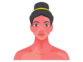 Young Girl Character with Skin Problem on White Background. vector