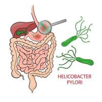 HELICOBACTER PYLORI Medicine Education Diagram Vector Set