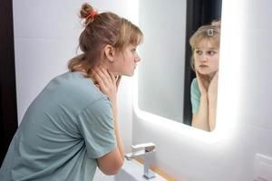 Teen girl looks in the mirror at problem skin photo