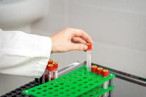 Nurse takes empty blood test tube photo